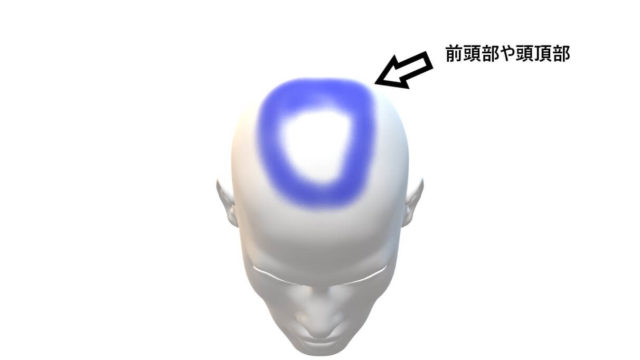 人間の前頭部と頭頂部のイメージ図